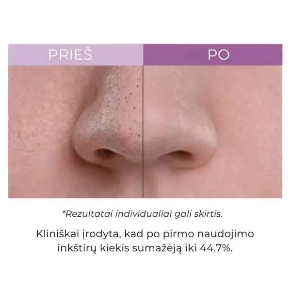 Valomasis balzamas Arocell Super Collagen Melting Cleansing Balm 100g - Image 3